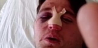 Difende fratello derubato, picchiato a sangue dal branco a Canosa